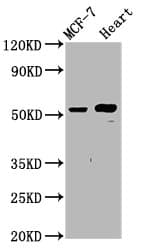 GLTSCR2 Antibody