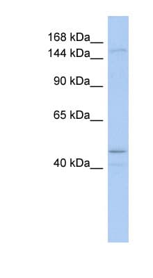 Polyclonal Rabbit anti-Human SKIV2L / SKI2 Antibody (aa863-912, WB)