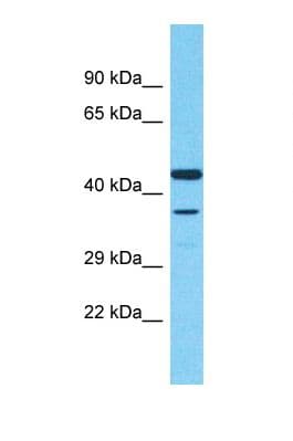 Scramblase / PLSCR1 Antibody (aa121-170)