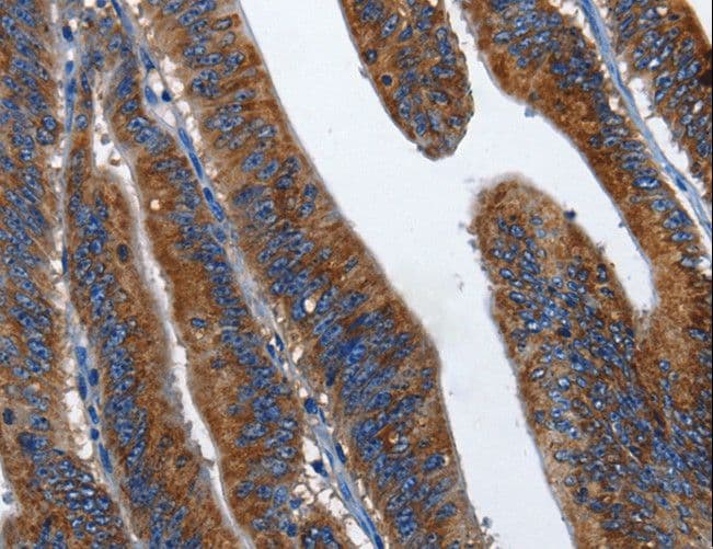 CD27 Antibody