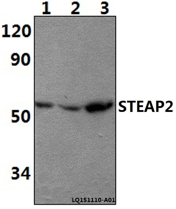 STEAP2 Antibody