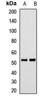 CALCRL / CGRP Receptor Antibody