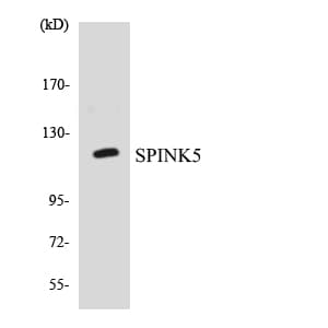 SPINK5 / LEKTI Antibody (aa476-525)