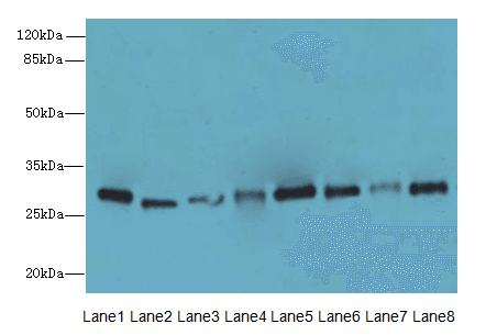 PLP1 / Myelin PLP Antibody (aa143-197)