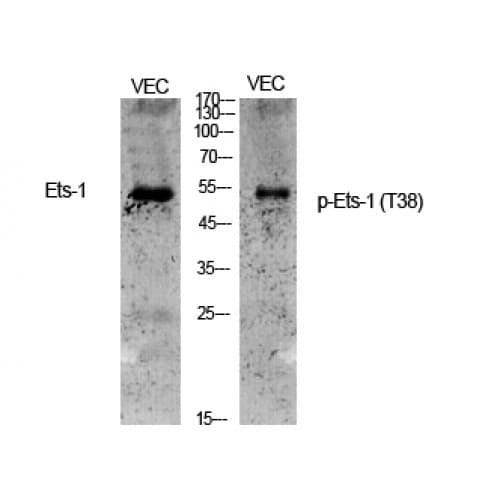 Polyclonal Rabbit anti-Human ETS1 / ETS-1 Antibody (30-110 aa, IHC, IF, WB)