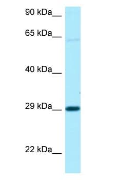 NIPA1 Antibody (C-Terminus)