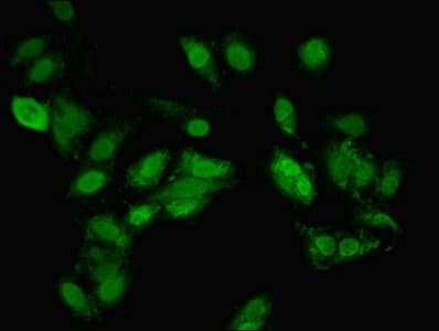 TANK2 / TNKS2 Antibody