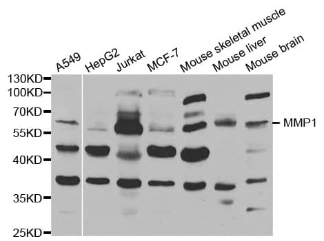 Polyclonal Rabbit anti-Human MMP1 Antibody (IHC, WB)