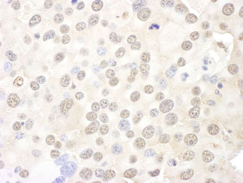 BOP1 Antibody (aa350-400)
