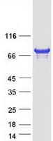 Human CENPB Protein (Recombinant Myc-DDK (Flag))