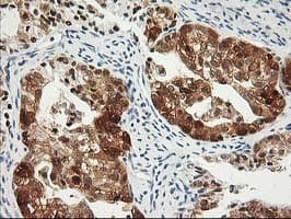 PDXK / PNK Antibody (clone OTI3G2)