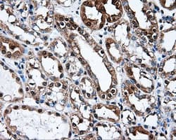 Monoclonal Mouse anti-Human L1CAM Antibody (clone OTI2H5, IHC, IF, WB)