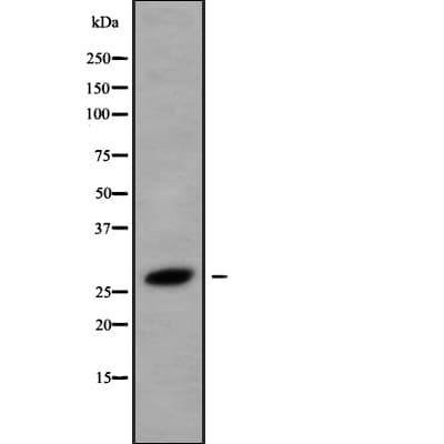 HOXB8 Antibody