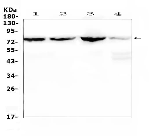 CAPN2 / Calpain 2 / M-Calpain Antibody