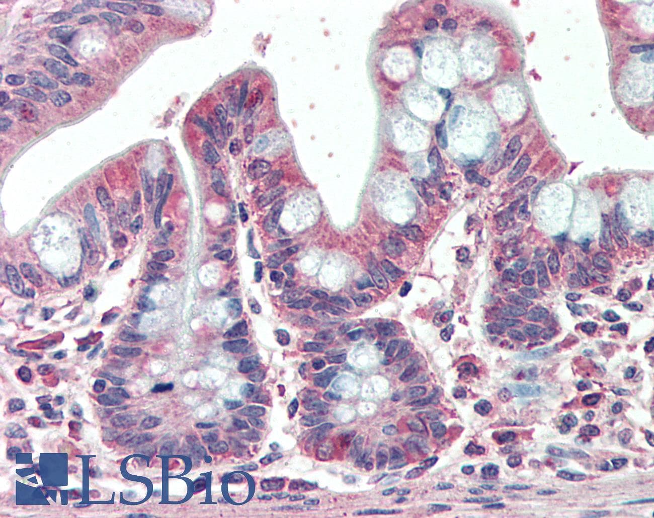 IHC-plus™ Polyclonal Goat anti-Human EML5 Antibody (aa1326-1337, IHC)