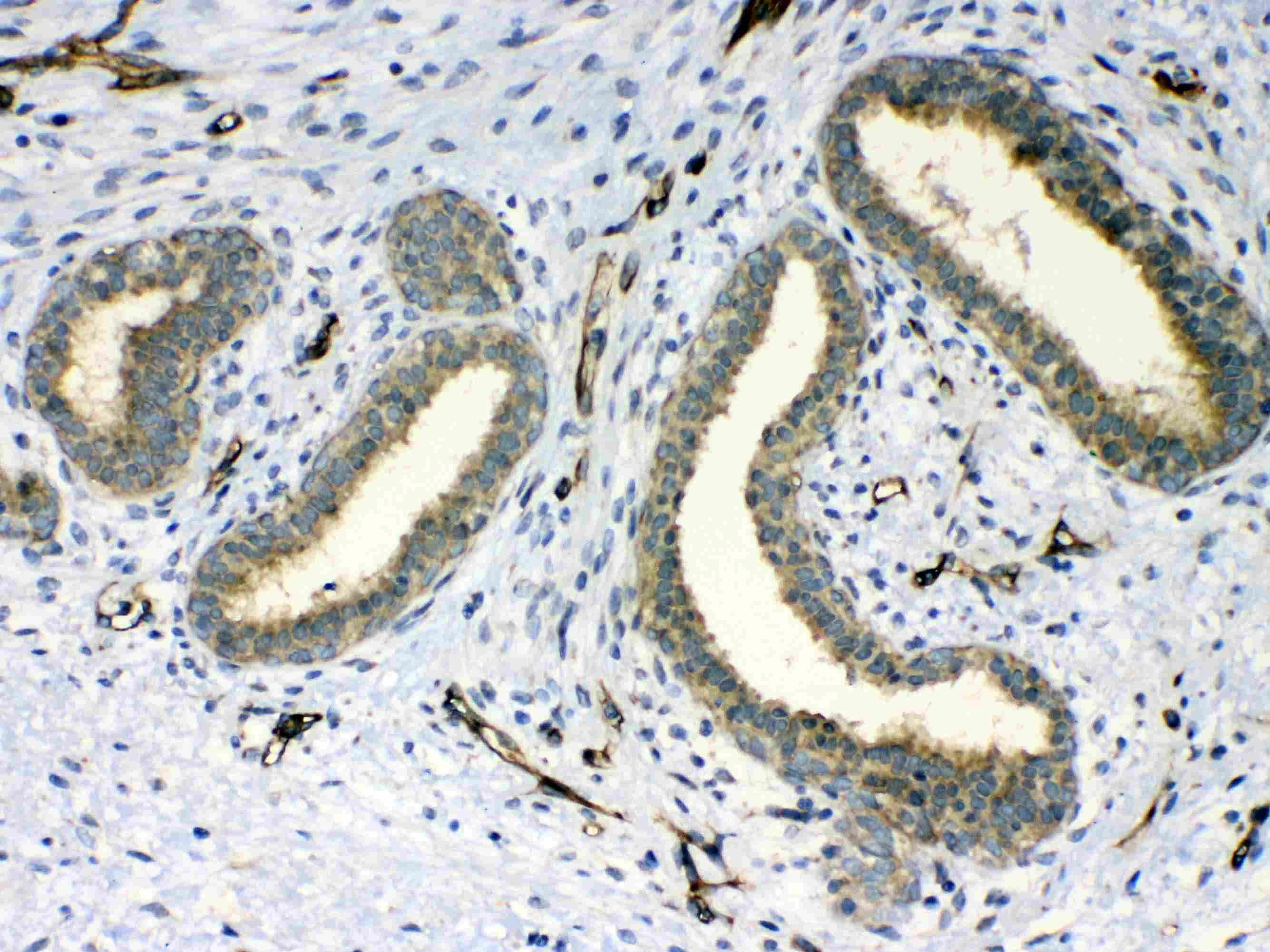 PPID / Cyclophilin D Antibody