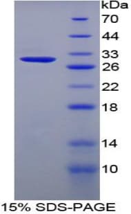 Rat CSPG5 / Neuroglycan C Protein (Recombinant His-T7)