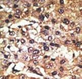 PAEL Receptor / GPR37 Antibody (aa97-126)