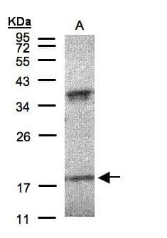 IFNA6 / Interferon Alpha 6 Antibody (aa125-189)