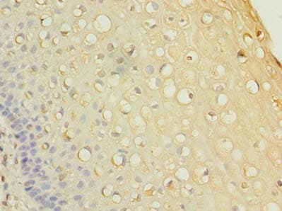 Polyclonal Rabbit anti-Human RNF148 Antibody (IHC, WB)