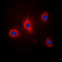 GRB10 Antibody (phospho-Tyr67)