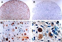 CFLAR / FLIP Antibody (aa75-92)