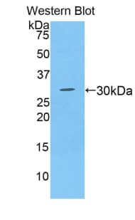 ADAM28 Antibody (aa525-774)