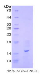 Human MLN / Motilin Protein (Recombinant His-S)