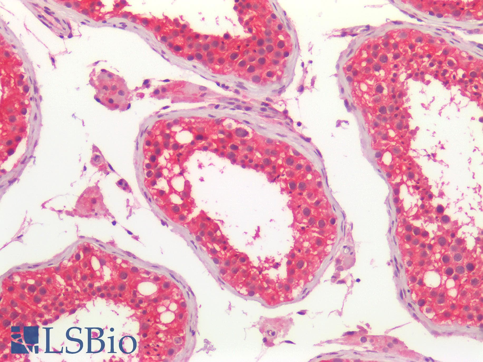 PathPlus™ Monoclonal Mouse anti-Human NDRG1 Antibody (clone 2D7, IHC, IF, WB)