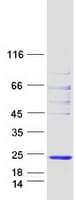 Human WBP5 Protein (Recombinant Myc-DDK (Flag))