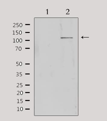 Polyclonal Rabbit anti-Human MBTPS1 / S1P Antibody (IHC, IF, WB)