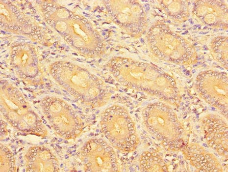 SLC51A / OSTalpha Antibody