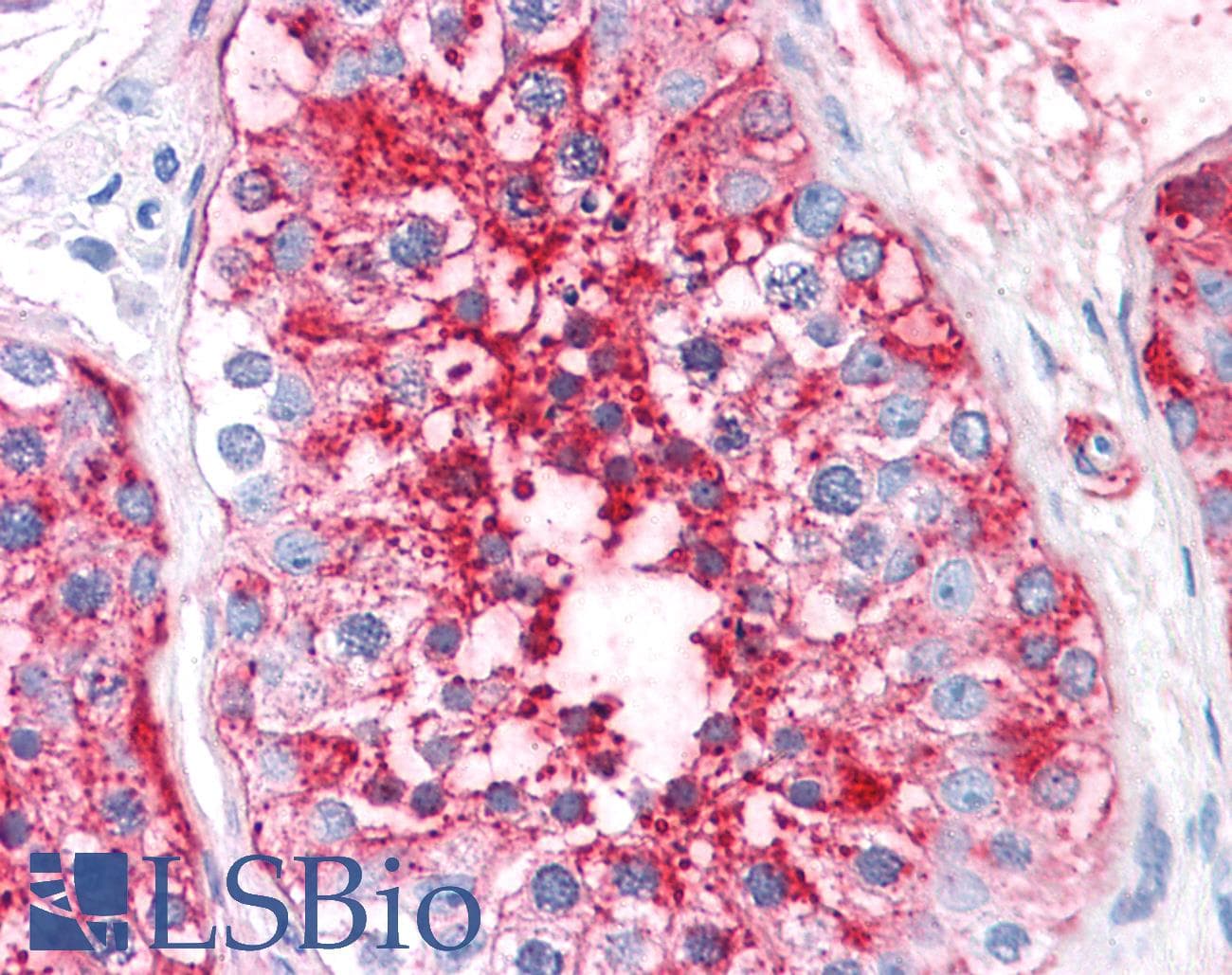 IHC-plus™ ADAM20 Antibody (Internal)