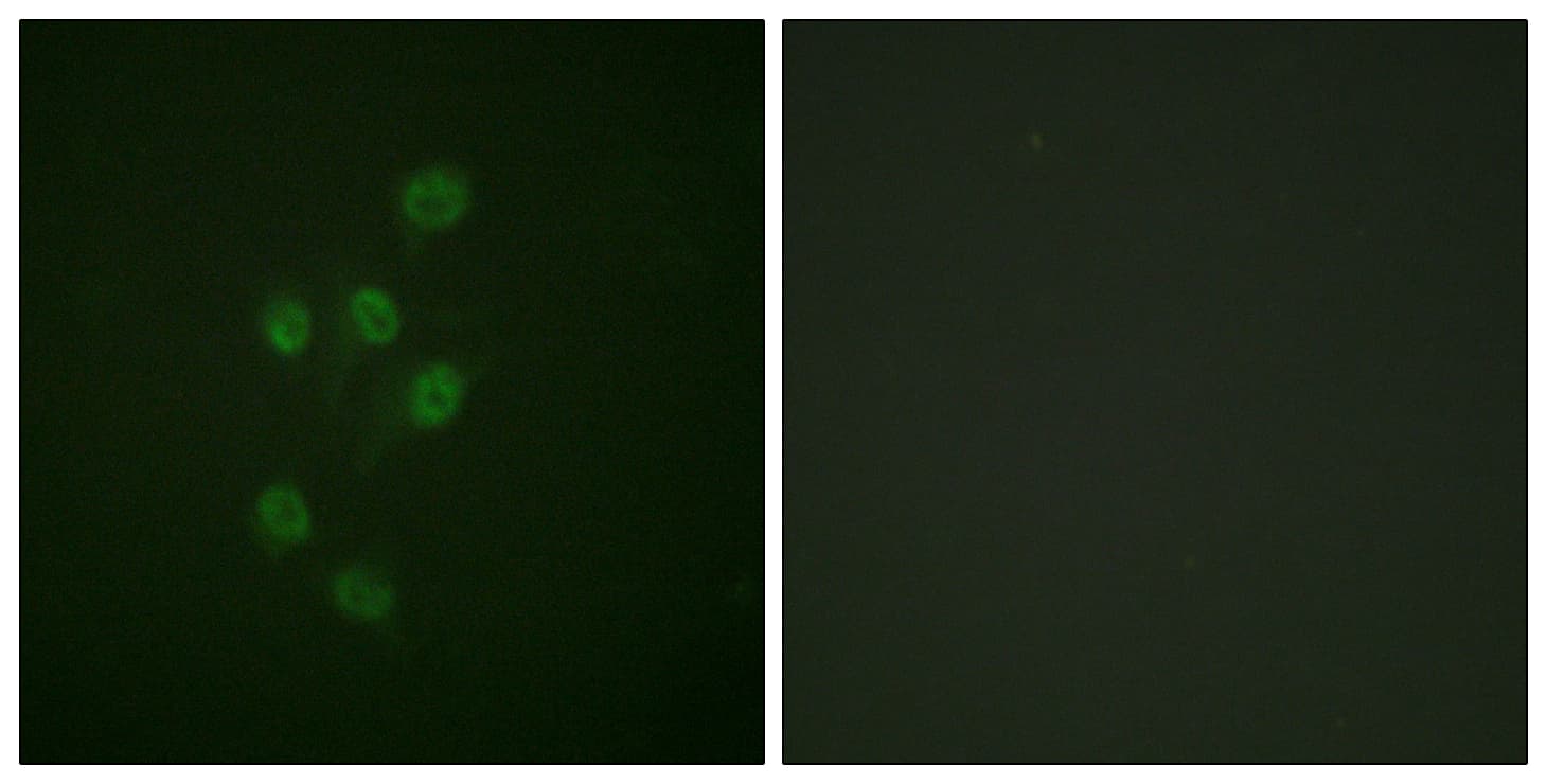 HDAC3 Antibody (phospho-Ser424)