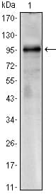 IHC-plus™ Monoclonal Mouse anti-Human CRTC1 / MECT1 / TORC1 Antibody (clone 1B5, IHC, IF, WB)