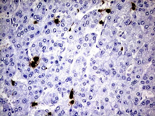 Monoclonal Mouse anti-Human S100A9 / MRP14 Antibody (clone UMAB173, Carrier-free, IHC, IF, WB)