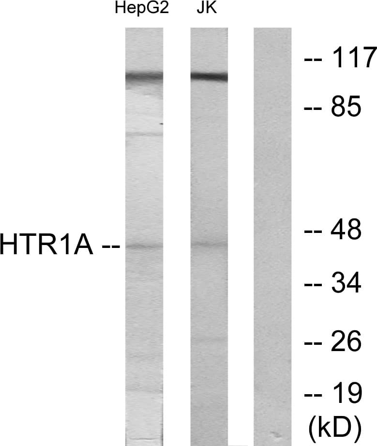 HTR1A / 5-HT1A Receptor Antibody (aa291-340)