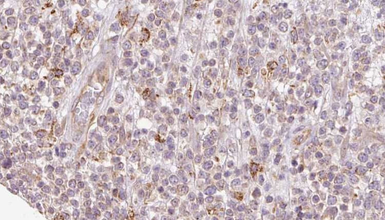 Polyclonal Rabbit anti-Human SH3KBP1 / CIN85 Antibody (IHC, IF, WB)
