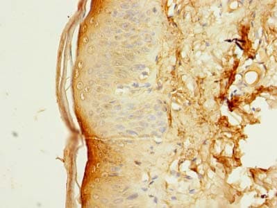 SLC38A7 Antibody