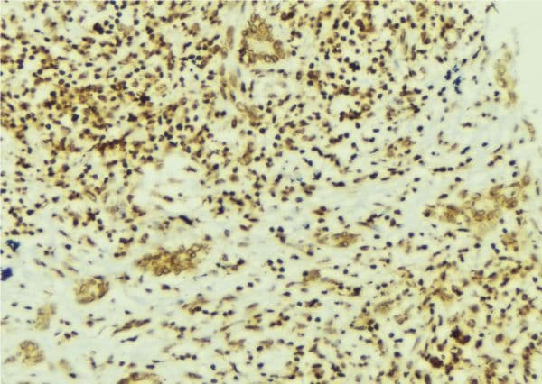 FAK / Focal Adhesion Kinase Antibody