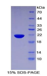 Human PHLDA2 / TSSC3 Protein (Recombinant His-T7)
