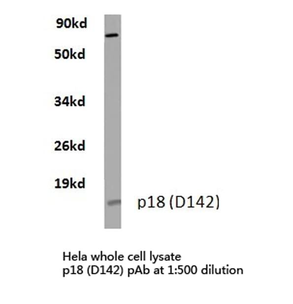 CDKN2C / p18 INK4c Antibody (Asp142)