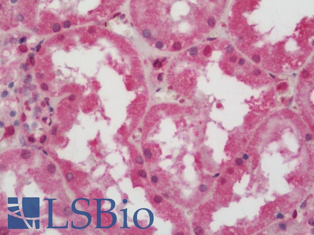 IHC-plus™ ATP6V0C / VATL Antibody (aa100-126)
