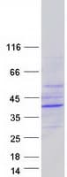 Human EPHX4 / Epoxide Hydrolase 4 Protein (Recombinant Myc-DDK (Flag))