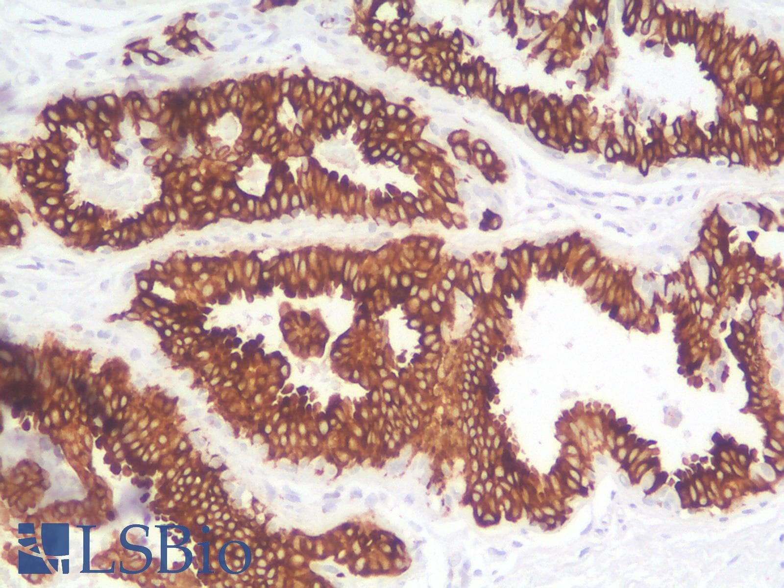 PathPlus™ KRT19 / CK19 / Cytokeratin 19 Antibody (Concentrated)