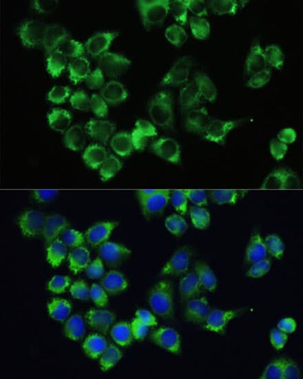 CDH1 / E Cadherin Antibody