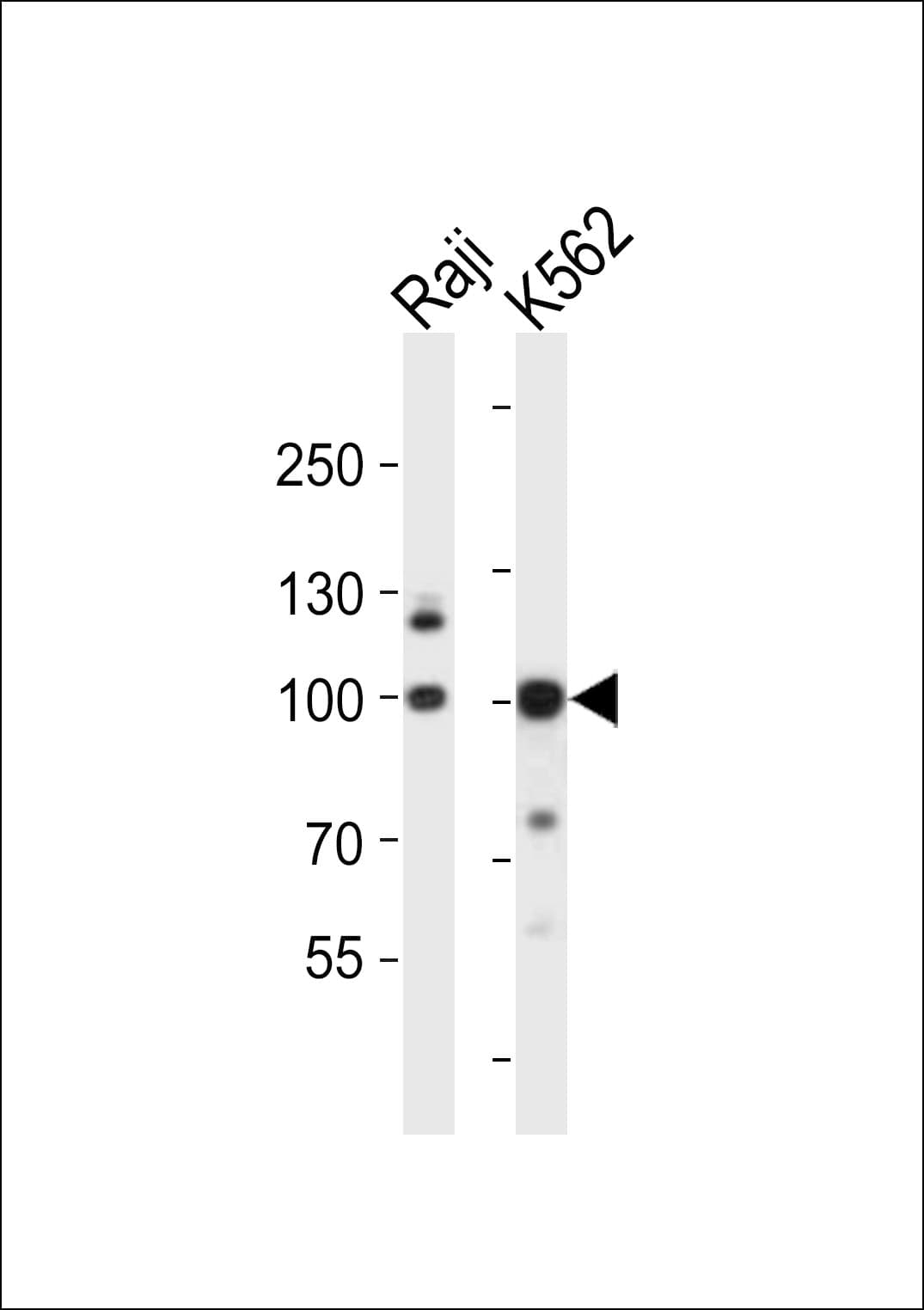 KDM1B Antibody (aa38-73)