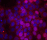 ER Alpha / Estrogen Receptor Antibody