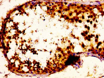 NOVA1 Antibody