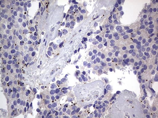 PRX-1 / PRRX1 Antibody (clone OTI1E10)